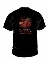 Aborted T-Shirt Coronary Reconstruction
